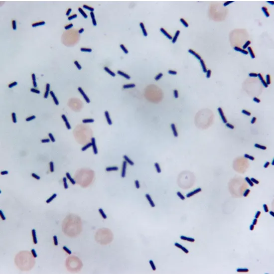 Clostridium Difficile In Stool By PCR